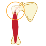Infraspinatus Symptoms
